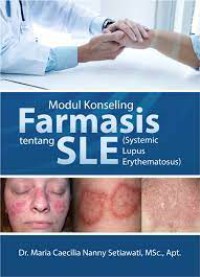 Modul Konseling Farmasis tentang SLE (Systemic Lupus Erythematosus)